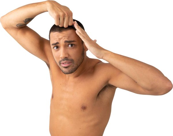 Comment fonctionne la greffe de cheveux sans cicatrice ?